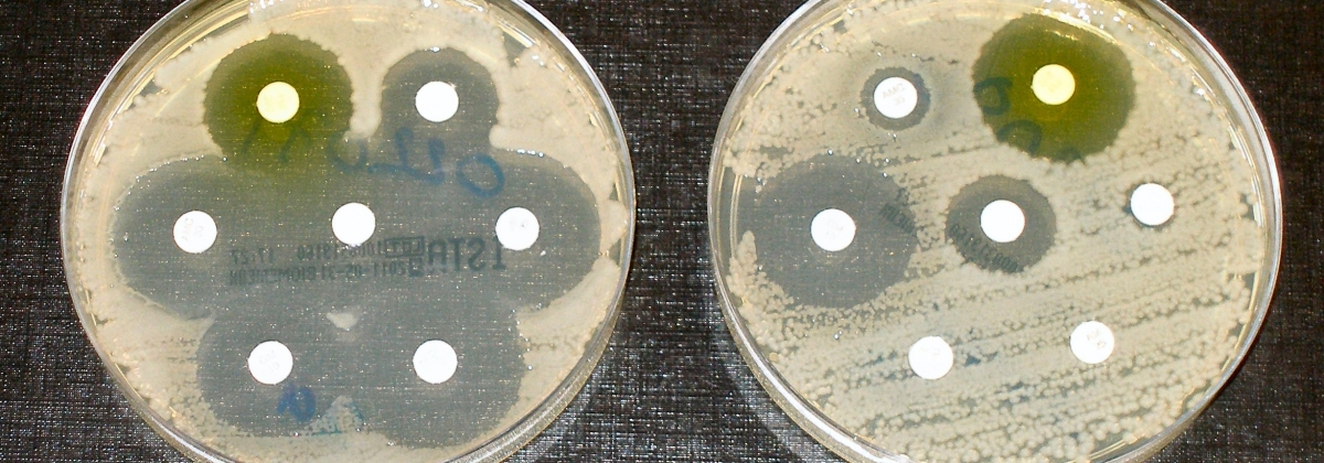 Conferencia: "Importancia de la teoría evolutiva en microbiología aplicada"