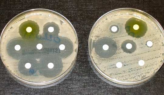 Conferencia: "Importancia de la teoría evolutiva en microbiología aplicada"
